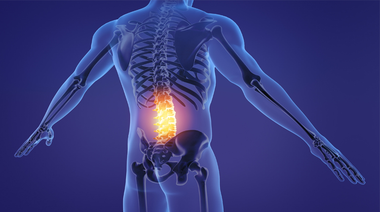 Dolor lumbar
